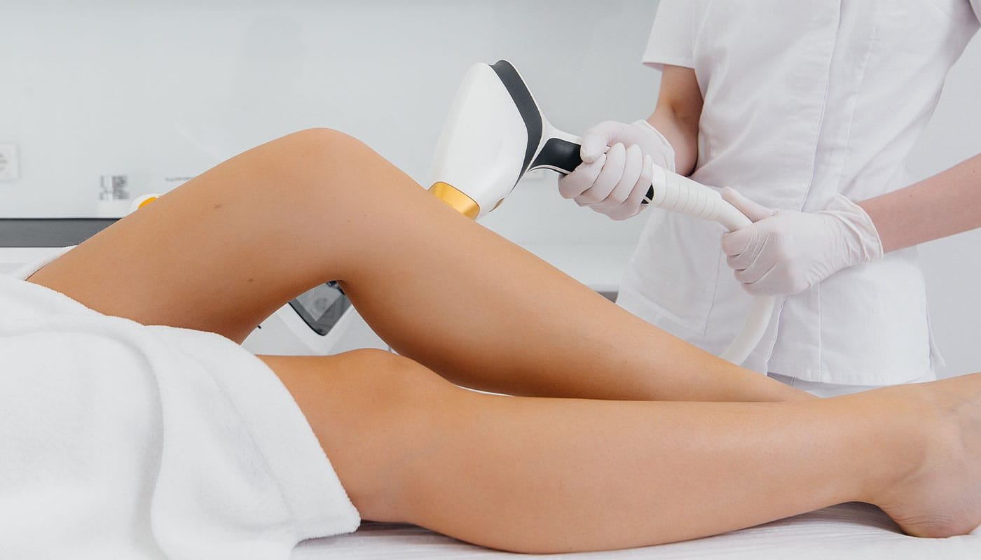 Laser Epilation