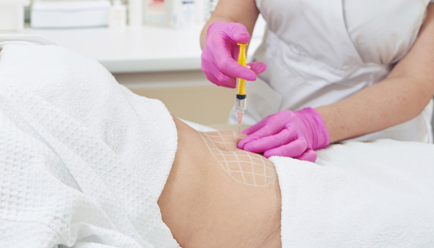 beauty injection lipolys