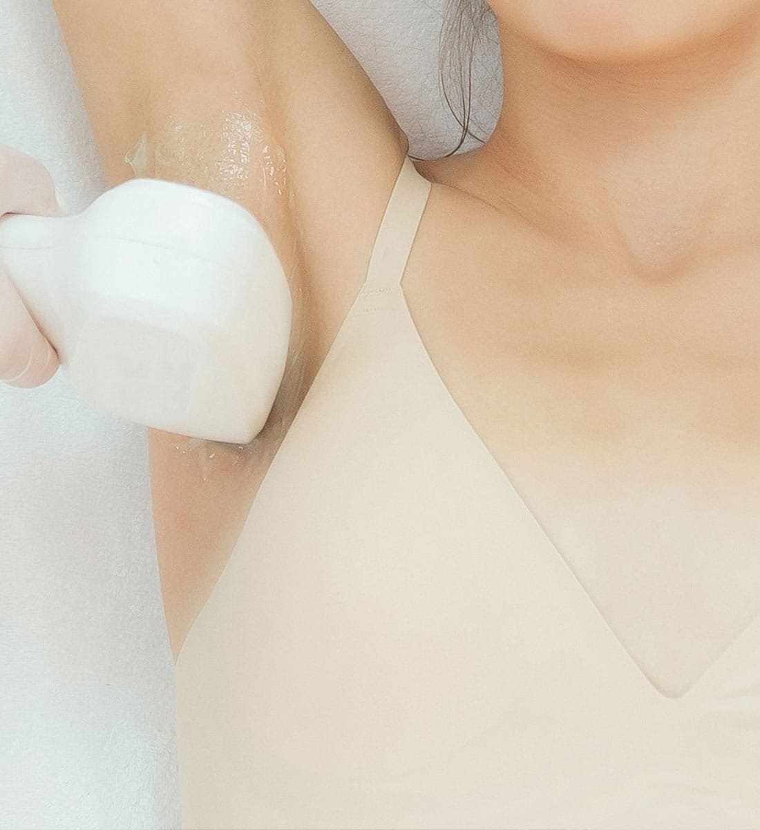 haarentfernung mit lazer epilation
