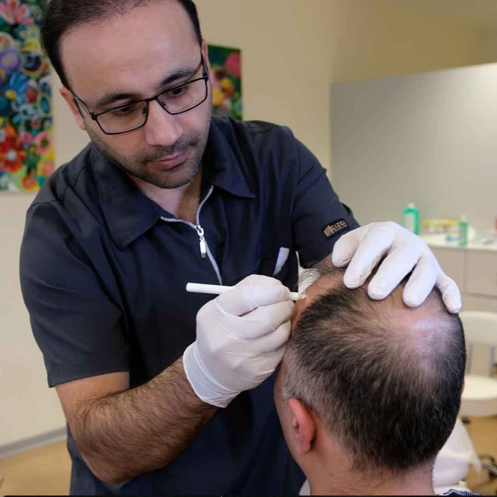 Haartransplantation 1 Wir bieten Ihnen in unserer Haarsprechstunde in Berlin eine fundierte Diagnose mithilfe modernster Technik und Haarbehandlung Erfahrung mit DR Onur.