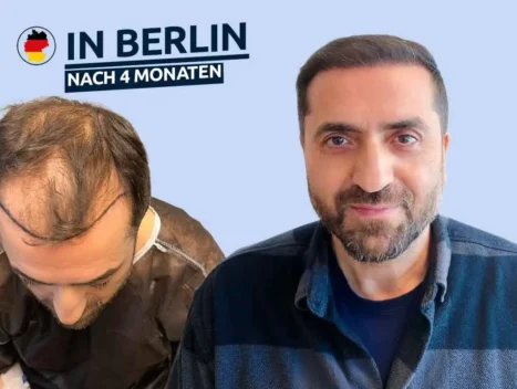 kudamm berlin haar