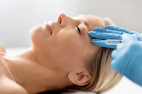 Fadenlifting Berlin – PDO-Fäden bei Ku'damm Aesthetic