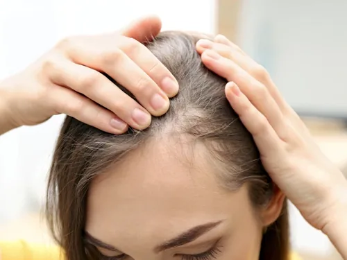 Haarausfall bei Frauen – Abklärung in Berlin