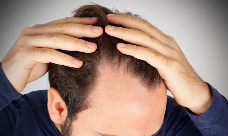 Haaranalyse und Untersuchung bei Haarausfall in Berlin
