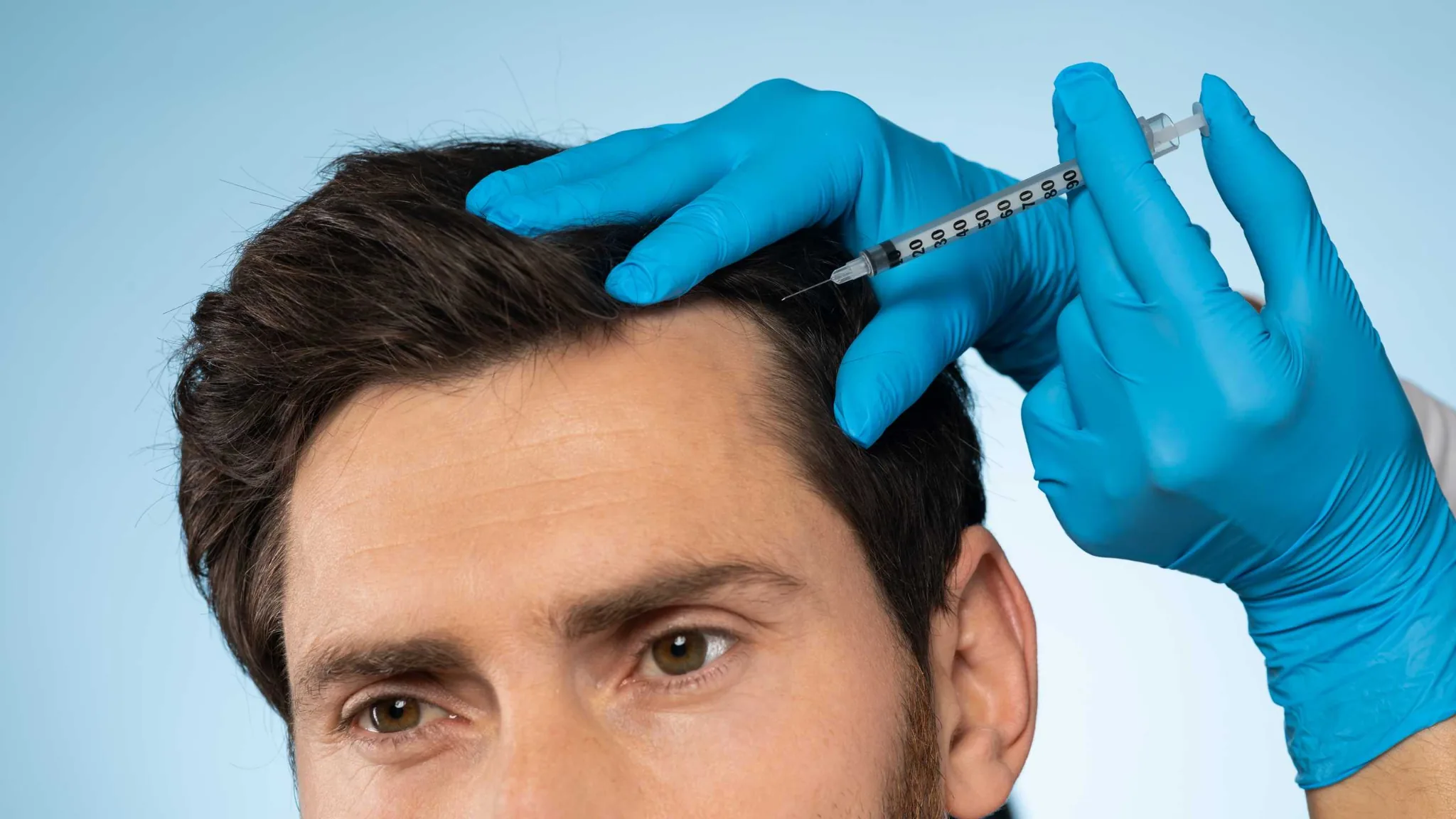 PRP-Therapie bei Haarausfall in Berlin