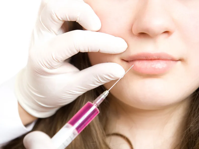Hyaluron-Behandlung der Lippen in Berlin