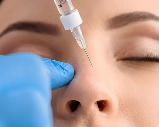 Nasenkorrektur ohne OP in Berlin 7 Hyaluron-Nasenkorrektur in Berlin
