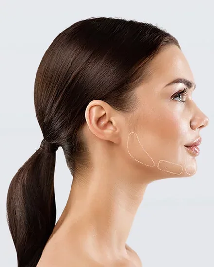 Jawline & Kinn unterspritzen in Berlin: Kontur, die zu Ihrem Profil passt 3 Kinn- und Kieferkontur im Profil, Berlin