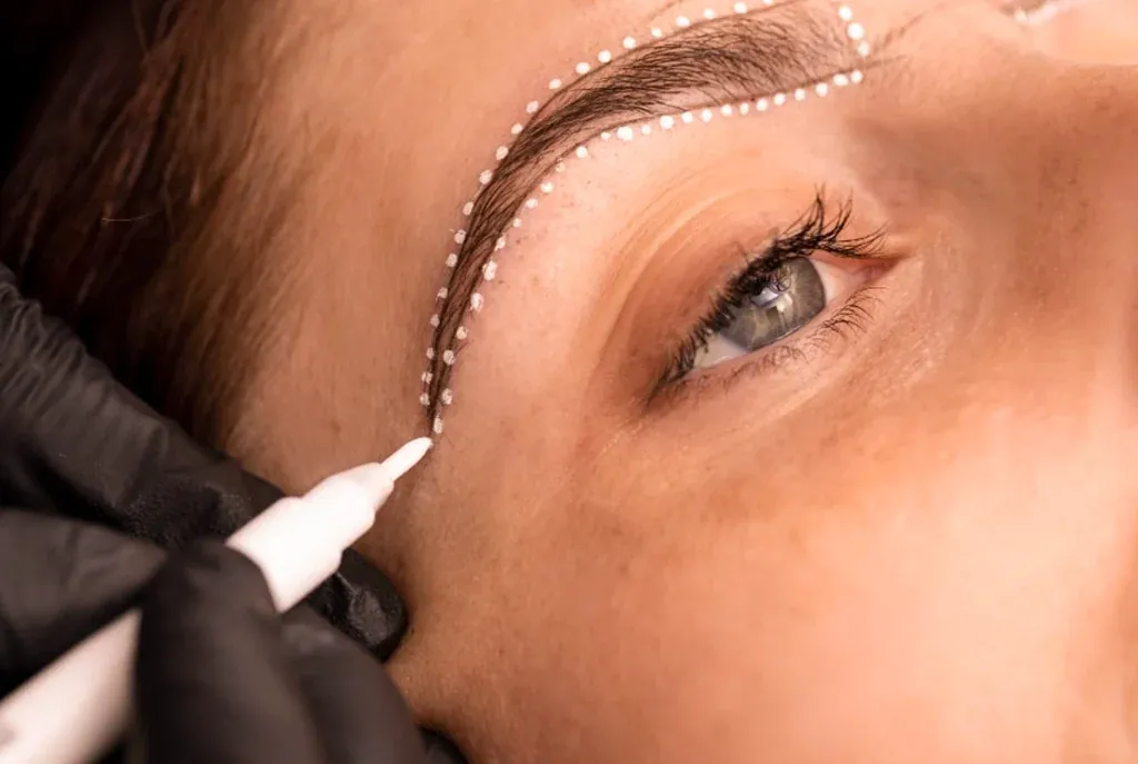 Formplanung einer Augenbrauentransplantation bei Ku'damm Aesthetic in Berlin