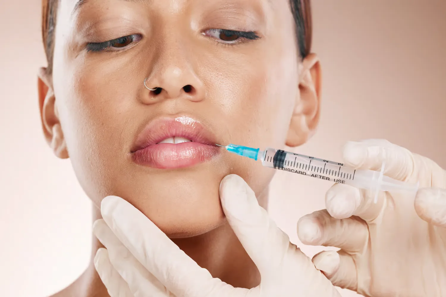 Lippenunterspritzung bei Ku'damm Aesthetic in Berlin