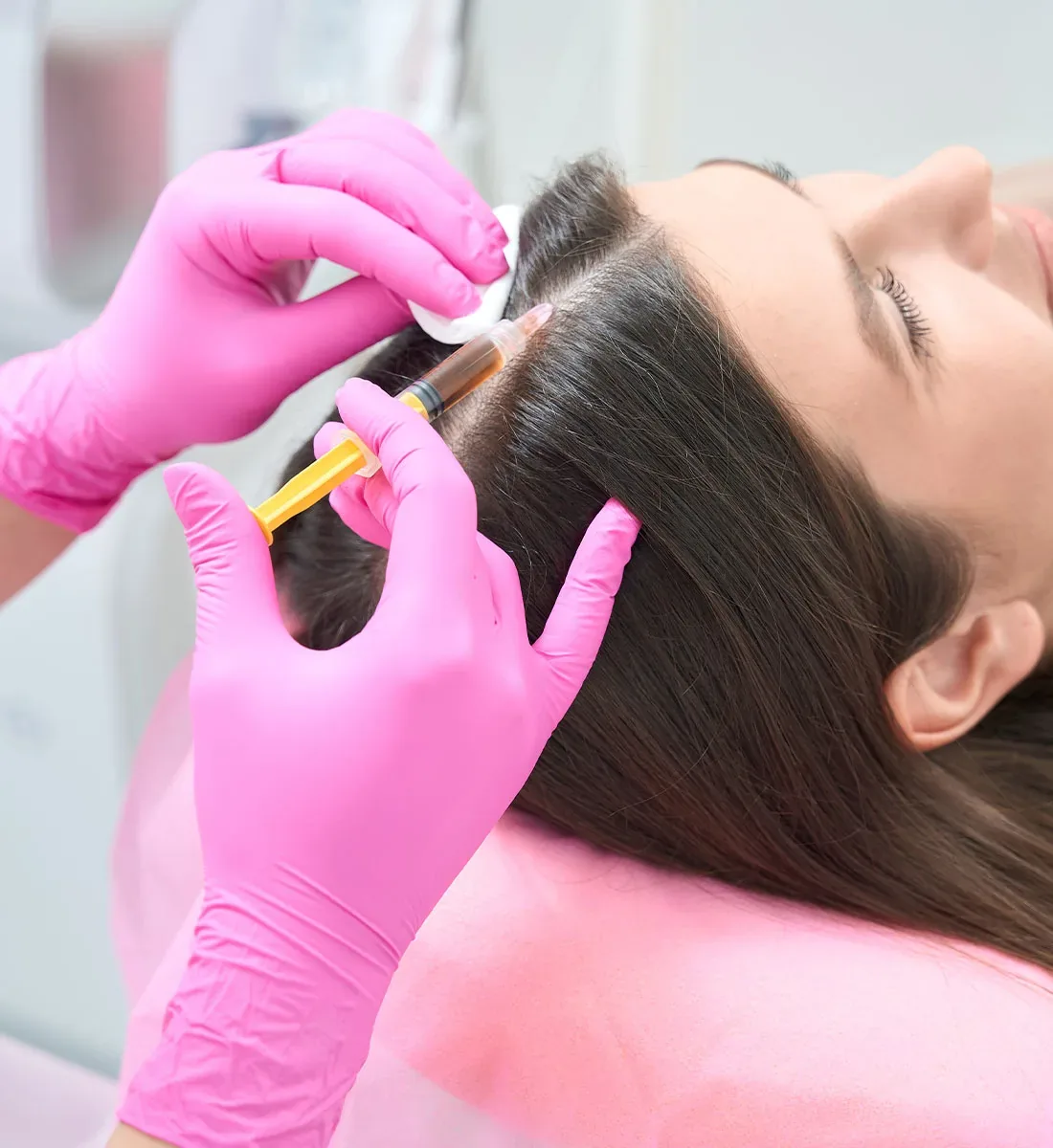 Mesotherapie 5 Mesotherapie der Kopfhaut bei Haarausfall in Berlin