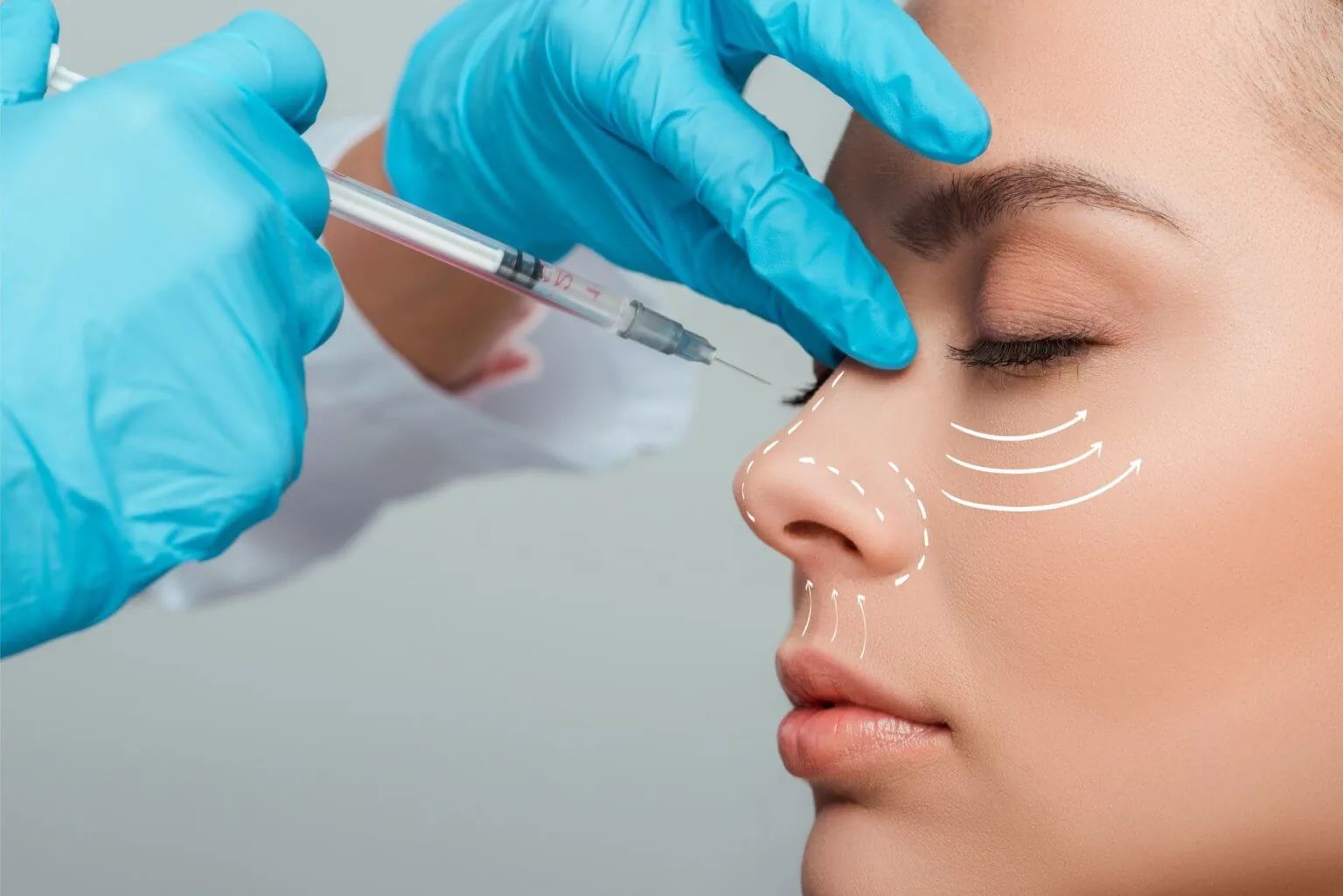 Nasenkorrektur ohne OP in Berlin 4 Nasenkorrektur ohne OP bei Ku'damm Aesthetic Berlin